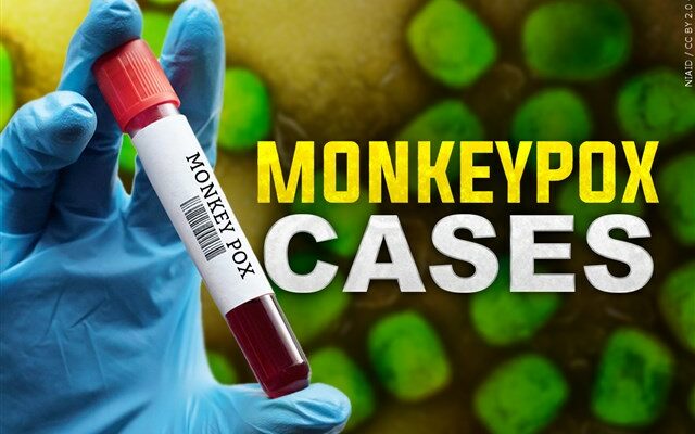 Oregon Reports First Monkeypox Case